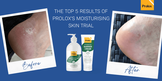 The Top 5 Results of Prolox's Moisturising Skin Trial