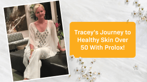 Tracey’s Journey to Healthy Skin Over 50 with Prolox
