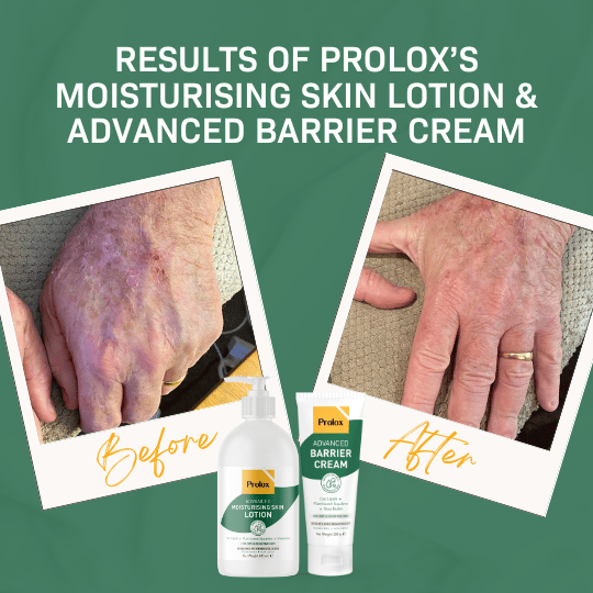 Prolox Moisturising Skin Lotion