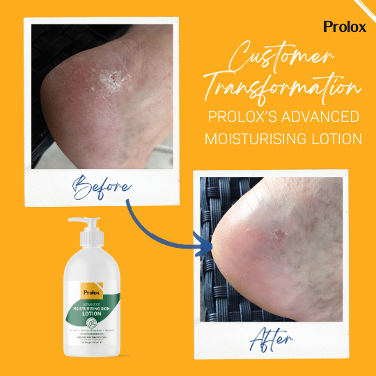 Prolox Moisturising Skin Lotion