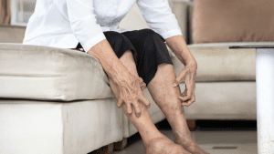 Pruritus: What is Pruritus and How to Treat It